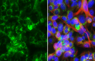 Anti-Seladin 1 antibody [HL3253] used in Immunocytochemistry/ Immunofluorescence (ICC/IF). GTX640900