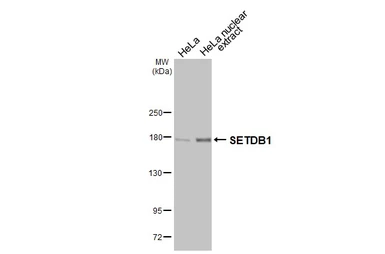 Anti-SETDB1 antibody [HL3259] used in Western Blot (WB). GTX640906