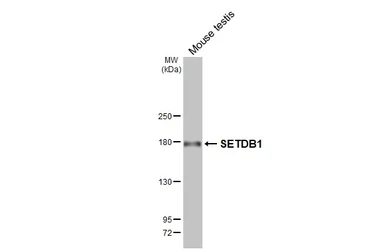 Anti-SETDB1 antibody [HL3259] used in Western Blot (WB). GTX640906