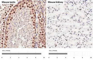 Anti-SETDB1 antibody [HL3259] used in IHC (Paraffin sections) (IHC-P). GTX640906