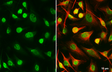 Anti-SETDB1 antibody [HL3260] used in Immunocytochemistry/ Immunofluorescence (ICC/IF). GTX640907