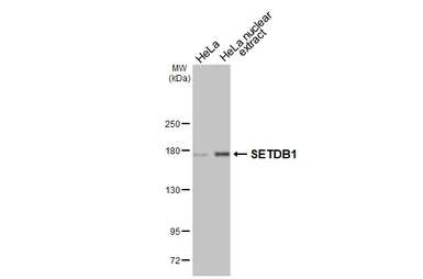 Anti-SETDB1 antibody [HL3260] used in Western Blot (WB). GTX640907
