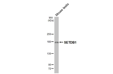 Anti-SETDB1 antibody [HL3260] used in Western Blot (WB). GTX640907