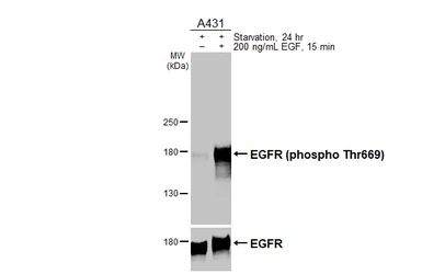 Anti-EGFR (phospho Thr669) antibody [HL3264] used in Western Blot (WB). GTX640911