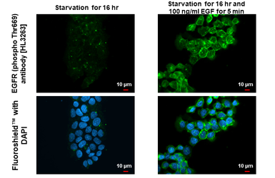 Anti-EGFR (phospho Thr669) antibody [HL3265] used in Immunocytochemistry/ Immunofluorescence (ICC/IF). GTX640912