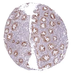 Anti-SDHA antibody [HMV336] HistoMAX&trade; used in IHC (Paraffin sections) (IHC-P). GTX640916