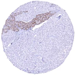 Anti-SDHA antibody [HMV336] HistoMAX&trade; used in IHC (Paraffin sections) (IHC-P). GTX640916