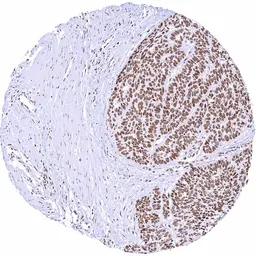 Anti-SMARCA2 antibody [HMV337] HistoMAX&trade; used in IHC (Paraffin sections) (IHC-P). GTX640917