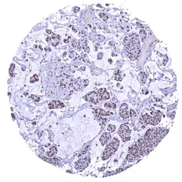 Anti-SMARCA2 antibody [HMV337] HistoMAX&trade; used in IHC (Paraffin sections) (IHC-P). GTX640917
