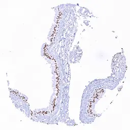 Anti-SOX2 antibody [HMV338] HistoMAX&trade; used in IHC (Paraffin sections) (IHC-P). GTX640918