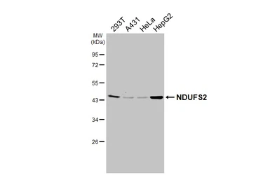 Anti-NDUFS2 antibody [HL3269] used in Western Blot (WB). GTX640923