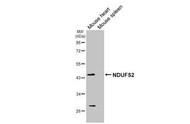 Anti-NDUFS2 antibody [HL3269] used in Western Blot (WB). GTX640923