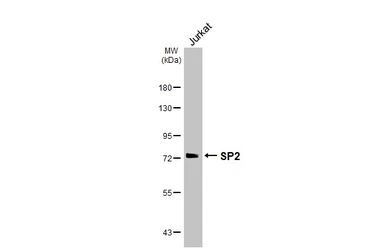 Anti-SP2 antibody [HL3271] used in Western Blot (WB). GTX640925