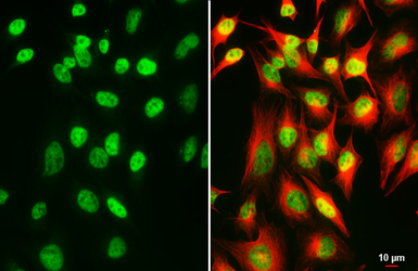 Anti-SP2 antibody [HL3271] used in Immunocytochemistry/ Immunofluorescence (ICC/IF). GTX640925