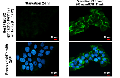 Anti-Her2 / ErbB2 (phospho Tyr1139) antibody [HL3272] used in Immunocytochemistry/ Immunofluorescence (ICC/IF). GTX640926