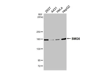 Anti-SMG6 antibody [HL3274] used in Western Blot (WB). GTX640928