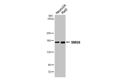 Anti-SMG6 antibody [HL3274] used in Western Blot (WB). GTX640928