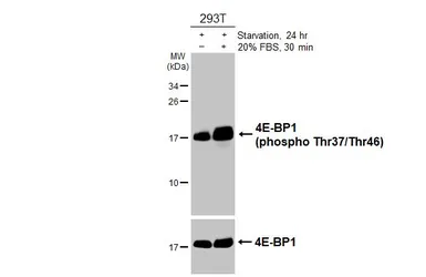 Anti-4E-BP1 (phospho Thr37/Thr46) antibody [HL3276] used in Western Blot (WB). GTX640930