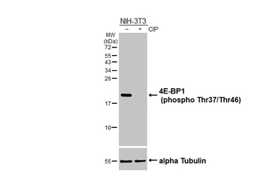 Anti-4E-BP1 (phospho Thr37/Thr46) antibody [HL3276] used in Western Blot (WB). GTX640930