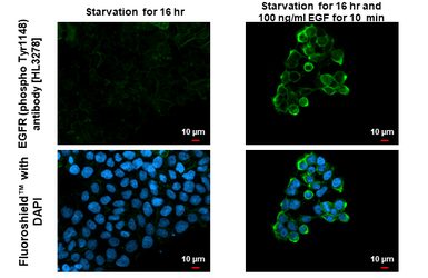Anti-EGFR (phospho Tyr1148) antibody [HL3278] used in Immunocytochemistry/ Immunofluorescence (ICC/IF). GTX640932