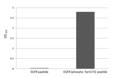 Anti-EGFR (phospho Tyr1173) antibody [HL3280] used in  (). GTX640934