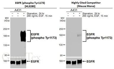 Anti-EGFR (phospho Tyr1173) antibody [HL3280] used in Western Blot (WB). GTX640934