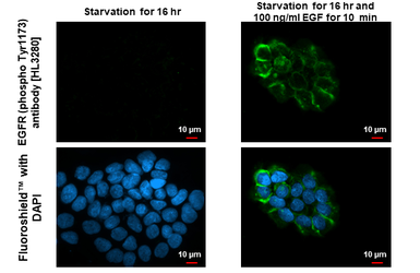 Anti-EGFR (phospho Tyr1173) antibody [HL3280] used in Immunocytochemistry/ Immunofluorescence (ICC/IF). GTX640934