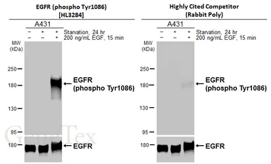 Anti-EGFR (phospho Tyr1086) antibody [HL3284] used in Western Blot (WB). GTX640938