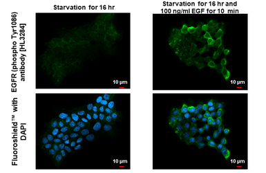 Anti-EGFR (phospho Tyr1086) antibody [HL3284] used in Immunocytochemistry/ Immunofluorescence (ICC/IF). GTX640938