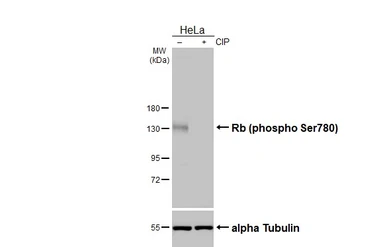 Anti-Rb (phospho Ser780) antibody [HL3285] used in Western Blot (WB). GTX640939