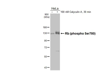 Anti-Rb (phospho Ser780) antibody [HL3285] used in Western Blot (WB). GTX640939