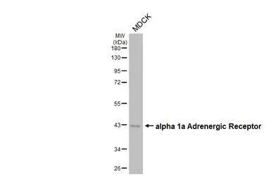 Anti-alpha 1a Adrenergic Receptor antibody [HL3291] used in Western Blot (WB). GTX640945