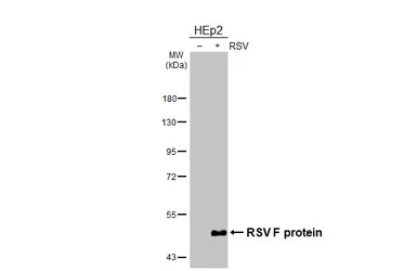 Anti-Respiratory Syncytial virus Fusion protein antibody [GT19] used in Western Blot (WB). GTX640950