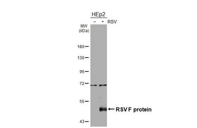 Anti-Respiratory Syncytial virus Fusion protein antibody [GT20] used in Western Blot (WB). GTX640951