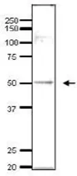 Anti-Ada2 (S. cerevisiae) antibody used in Western Blot (WB). GTX64096