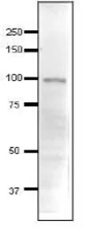 Anti-Ada3 / Ngg1 (S. cerevisiae) antibody used in Western Blot (WB). GTX64097