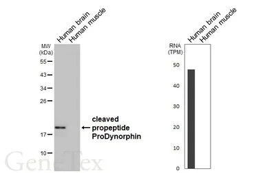 Anti-ProDynorphin antibody [HL3295] used in Western Blot (WB). GTX640984