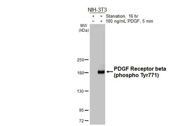 Anti-PDGF Receptor beta (phospho Tyr771) antibody [HL3300] used in Western Blot (WB). GTX640989