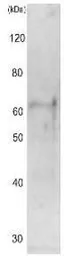 Anti-Cut15 (S. pombe) antibody used in Western Blot (WB). GTX64103