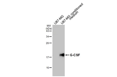 Anti-G-CSF antibody [GT21] used in Western Blot (WB). GTX641067