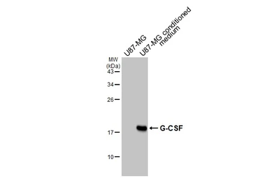 Anti-G-CSF antibody [GT22] used in Western Blot (WB). GTX641068