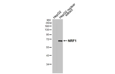 Anti-NRF1 antibody [HL3307] used in Western Blot (WB). GTX641069