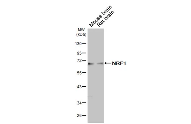 Anti-NRF1 antibody [HL3307] used in Western Blot (WB). GTX641069