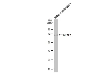 Anti-NRF1 antibody [HL3308] used in Western Blot (WB). GTX641070