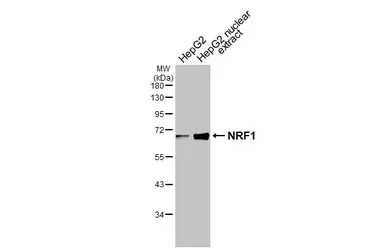 Anti-NRF1 antibody [HL3308] used in Western Blot (WB). GTX641070