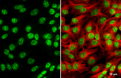 Anti-NRF1 antibody [HL3308] used in Immunocytochemistry/ Immunofluorescence (ICC/IF). GTX641070