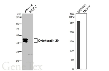 Anti-Cytokeratin 20 antibody [HL3309] used in Western Blot (WB). GTX641071