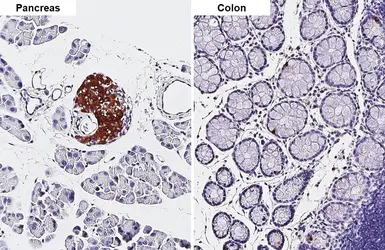 Anti-Chromogranin C antibody [HL3311] used in IHC (Paraffin sections) (IHC-P). GTX641073
