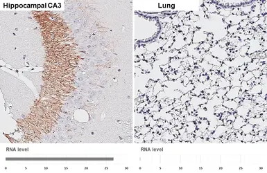 Anti-Chromogranin C antibody [HL3311] used in IHC (Paraffin sections) (IHC-P). GTX641073