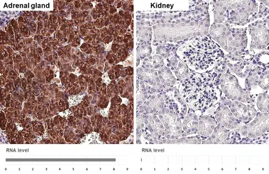 Anti-Chromogranin C antibody [HL3311] used in IHC (Paraffin sections) (IHC-P). GTX641073